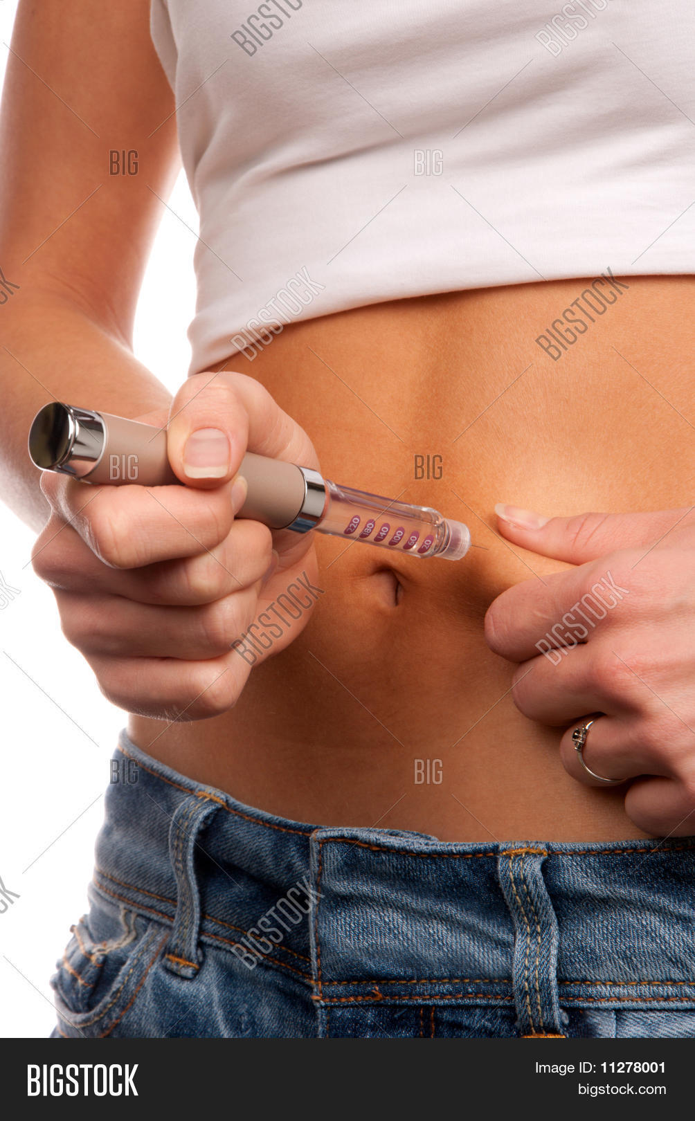 Инъекция гепарина в живот. Подкожная инъекция гепарина. Укол в живот инсулиновым шприцом. Укол в живот перед операцией зачем делают. Укол в живот перед операцией зачем делают.