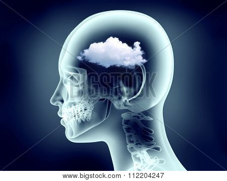 Xray Image Of Human Head With Clouds
