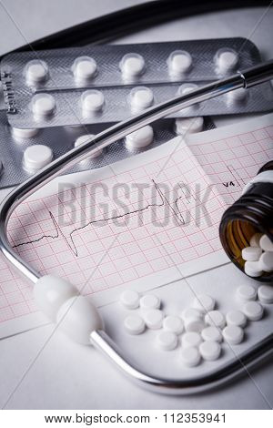 Cardiogram and nitroglycerin