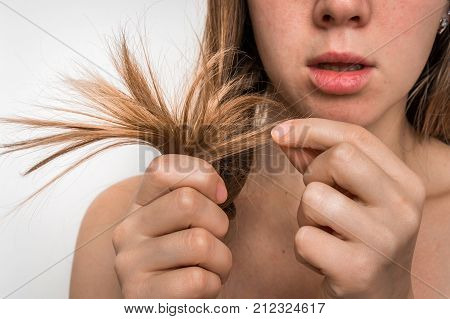 Hair Problems - Brittle, Damaged, Dry And Loss Hair Concept