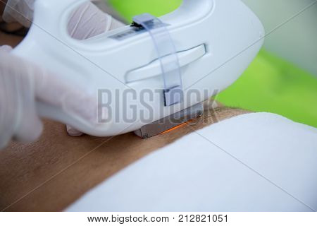 man receiving laser epilation at armpit on beauty center