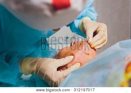 Aged Woman Doing Mesothreads And Thread Lifting, Cosmetology. Cosmetic Procedure To Eliminate Signs 