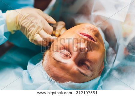 Aged Woman Doing Mesothreads And Thread Lifting, Cosmetology. Cosmetic Procedure To Eliminate Signs 