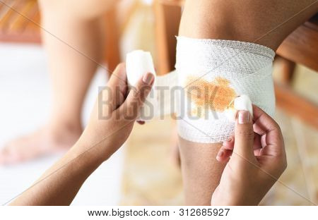 Wound Bandaging An Injured Knee From Fall And Bleeding / First Aid Leg Injury Health Care And Medici