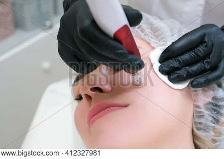 Needle Mesotherapy. Cosmetologist Performs Needle Mesotherapy On A Womans Face. Beautiful Woman Rece