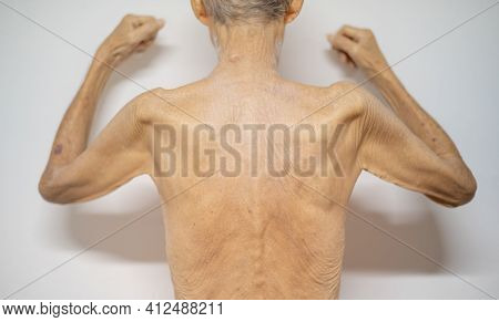 The Thin Old Back Man Skin With Close-up Old Skin With The Wrinkle Old Skin .