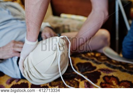 The Prosthetist Removes The Measure From A Person With A Disability, Man With Amputee.