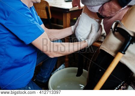 The Prosthetist Removes The Measure From A Person With A Disability, Woman With Amputee.