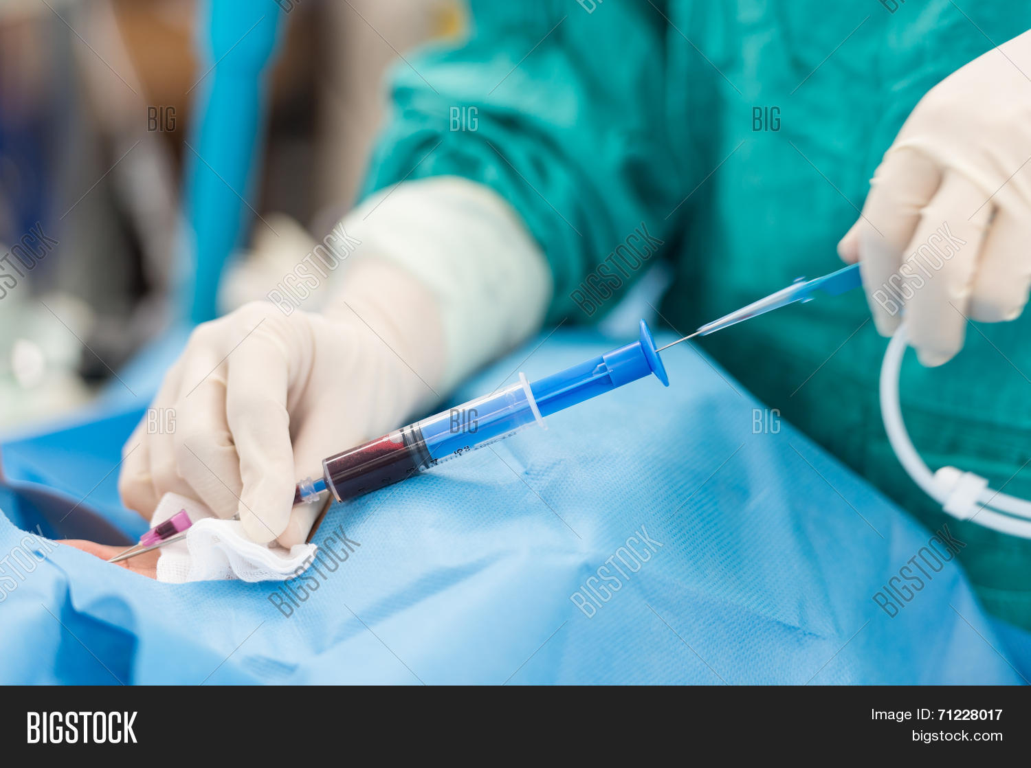 Guide Wire Injection Apply Guide Wire Image & Photo (Free Trial) | Bigstock