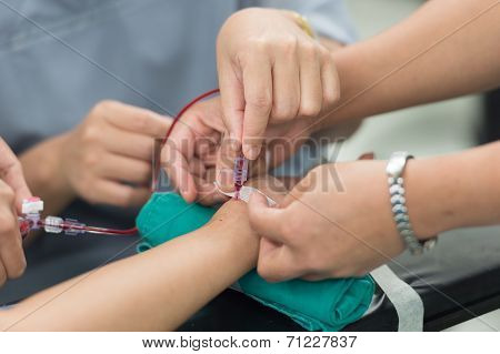 Stabilize Arterial Line