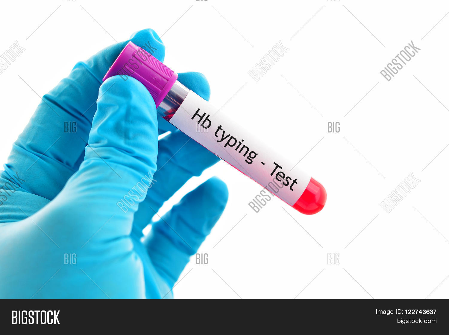 Blood Sample Image & Photo (Free Trial) Bigstock