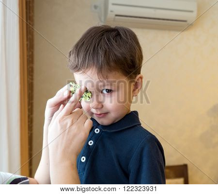 Eye patch. Portrait of a boy. Ophthalmology.