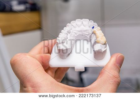 Technical shots of model on a dental prothetic laboratory.Dentist hand with plaster model