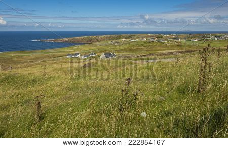View Of The Stairway To Heaven At Cuilcagh Mountain From The Top