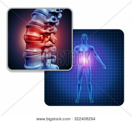 Human Back Joint Pain Concept As Skeleton And Muscle Anatomy Of The Body With Sore Spine Joints As A