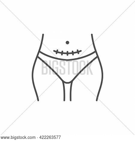 Cesarean Section Line Outline Icon Isolated On White