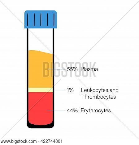 Platelet Rich Plasma Therapy. Blood Composition, Lymphocytes, Thrombocytes And Erythrocytes. Sample 