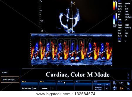 Colourful Ultrasound Monitor Image. Cardiac