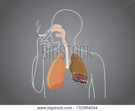 Human burned down lung with smoking. This illustration about health care.