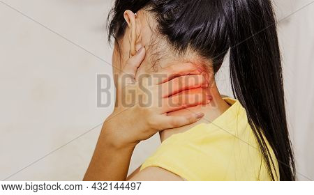 Back View Woman Pain In The Back Of The Neck, Degeneration Of The Neck, Moving Over The Nerve. Or Sp