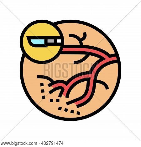 Blood Vessels Surgery Color Icon Vector. Blood Vessels Surgery Sign. Isolated Symbol Illustration