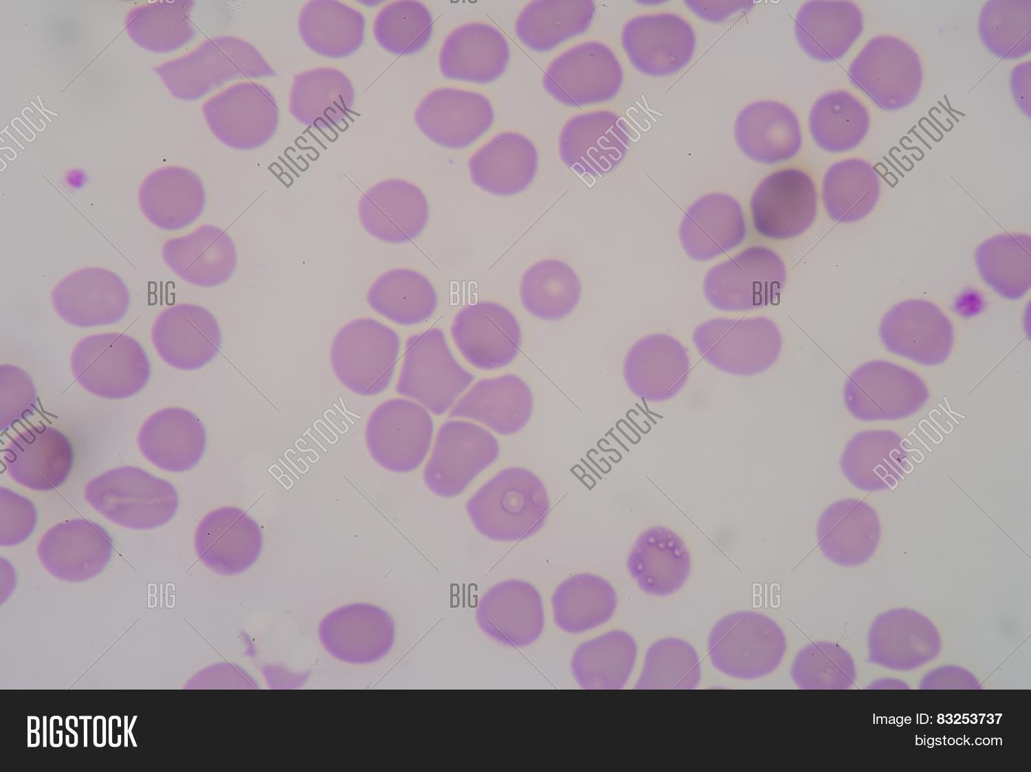Red Blood Cells Form Image & Photo (Free Trial) Bigstock