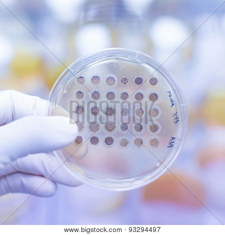 Fungi grown on agar plate.