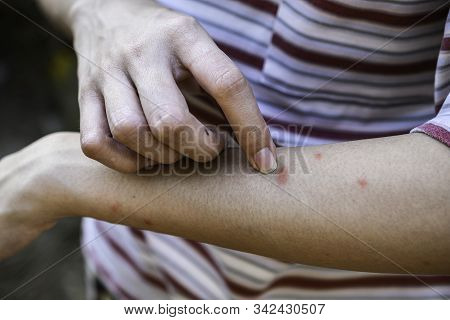 The Women Are Scratching Arms Herself From Itching In Healthy Concept On Nature Background.