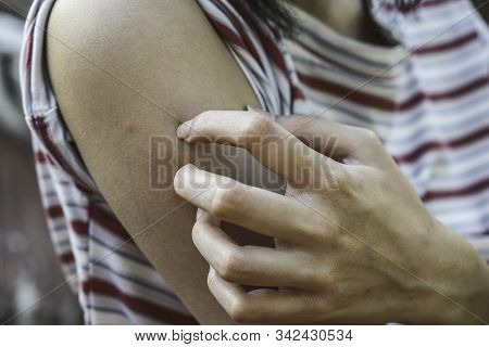 The Women Are Scratching Arms Herself From Itching In Healthy Concept On Nature Background.