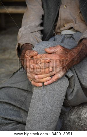 Detail Of The United And Calloused Hands While The Old Man Who Succumbed To Years