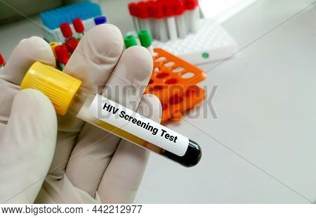 Sample Blood Collection Tube With Hiv Test Label. Hiv Infection Screening Test