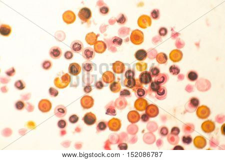Eggs of tapeworm Taenia pork tapeworm , a helminth transmitted to humans by raw or undercooked meat. Light microphotograph, magnification X100