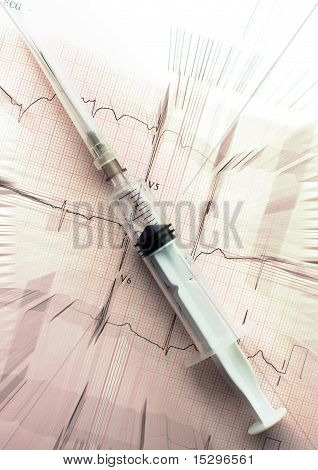 เข็มบน Electrocardiogram