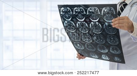 Medical Brain Concept. Doctor Check Up X-ray Film Of The Brain Patient By Mri Scan At Hospital.