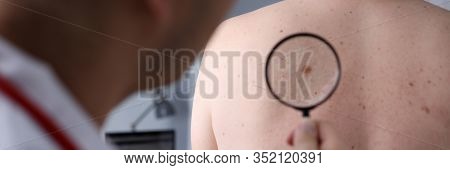 Male Doctor Look At Magnifying Glass On Patient Skin Against Hospital Office Background. Lesions Dan