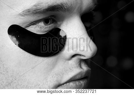 Man Face With Flakes Under The Eyes. Mans Flakes. Patches Under Close Eyes For Man. Close-up Of A Yo