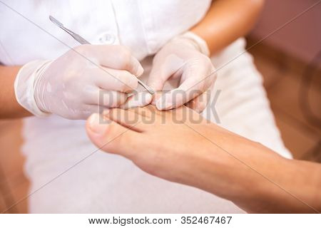 Pushing Back The Cuticles On Toes