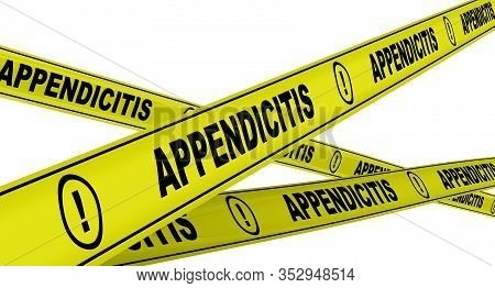 Appendicitis. Yellow Warning Tapes With Black Words Appendicitis (a Medical Condition In Which The A