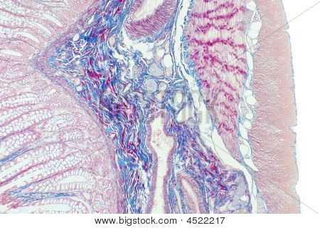 Auerbach Plexus