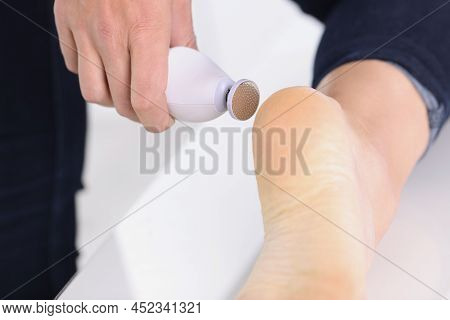 Pedicure And Foot Care. Body Care And Massage For Dry Skin Of Feet And Toes Concept