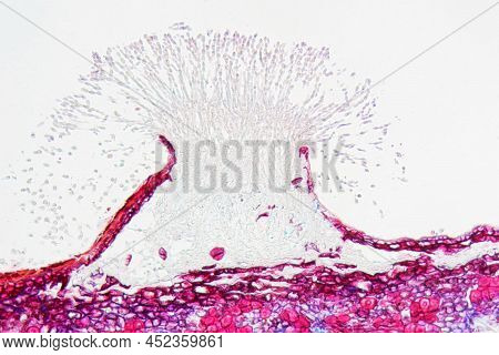 Monilinia Fructigena Under The Microscope