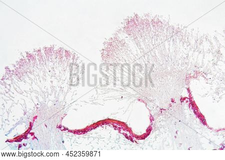 Monilinia Fructigena Under The Microscope
