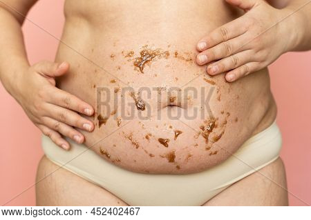 Cropped Of Overweight Fat Woman Holding Tummy Flabs With Obesity, Excess Fat. Cellulite Massage, Bur