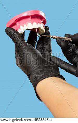Close-up View Of Dentist's Hands In Latex Gloves With A Layout Of The Human Jaw And A Plugger. Medic