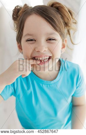 The Kid Lost A Tooth. Baby Without A Tooth. Portrait Of A Little Girl No Tooth. High Quality Photo