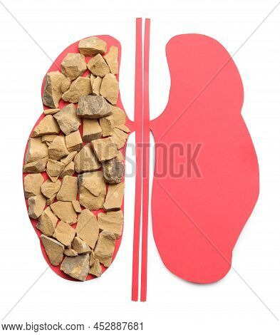 Kidneys Paper Cutout And Stones On White Background, Top View