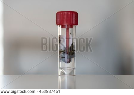 Feces Collected In Stool Examination Container For Human Stool Analysis