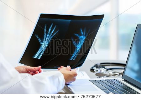 Doctor Hands Holding X Ray At Desk.