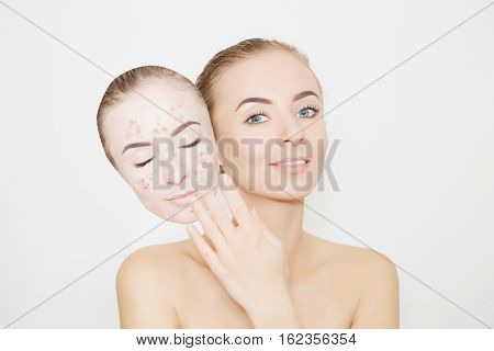 woman put away bad sking with pimples