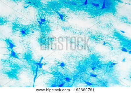 Cell Microscopic- Motor Neurous